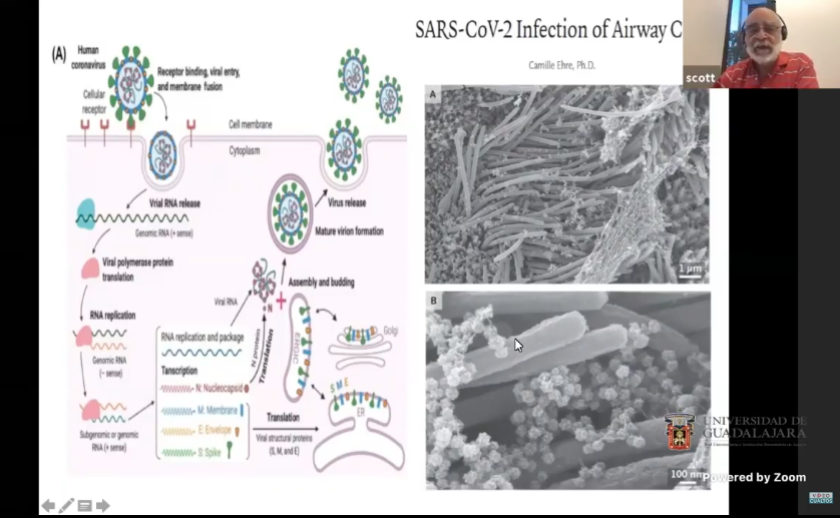 Captura de pantalla de una videollamada en la que se lee "SARS-CoV-2 Infection of Airway C".